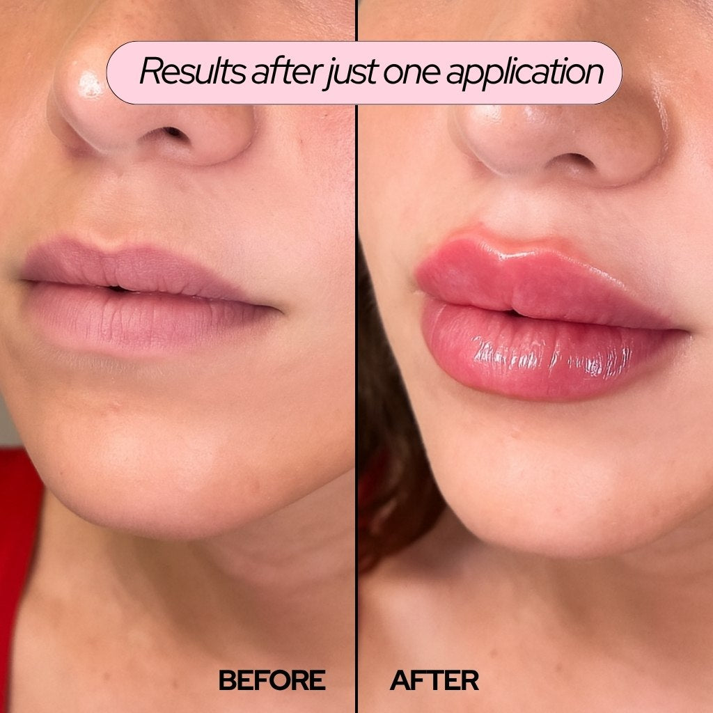 PinkLab™ Extreme Lip Plumper — 1+1 FREE